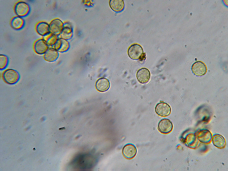 Ma non spariscono mai ?